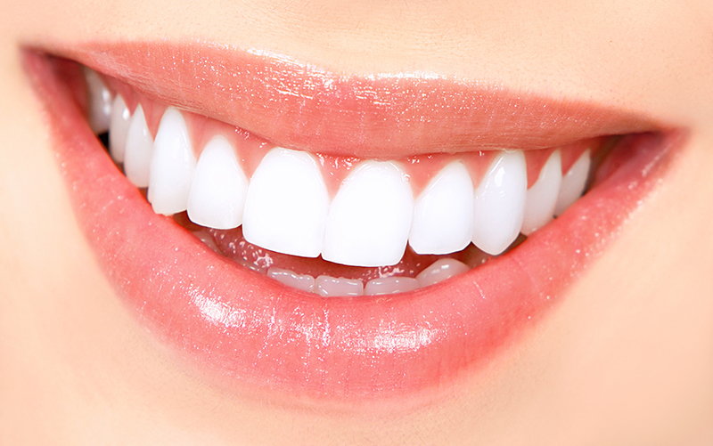 Blanqueamiento Dental En Metepec Blanqueamiento Dental En Metepec