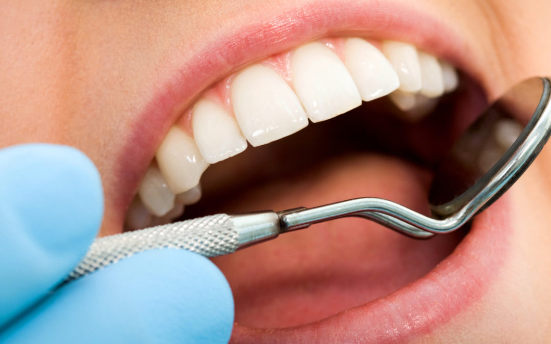 Limpieza Dental En Metepec