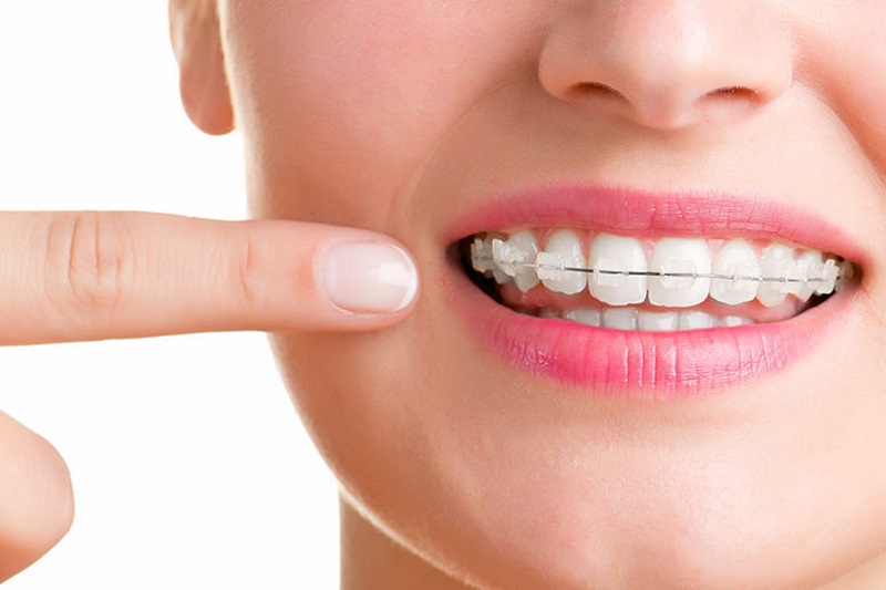 Ortodoncia En Toluca Costo